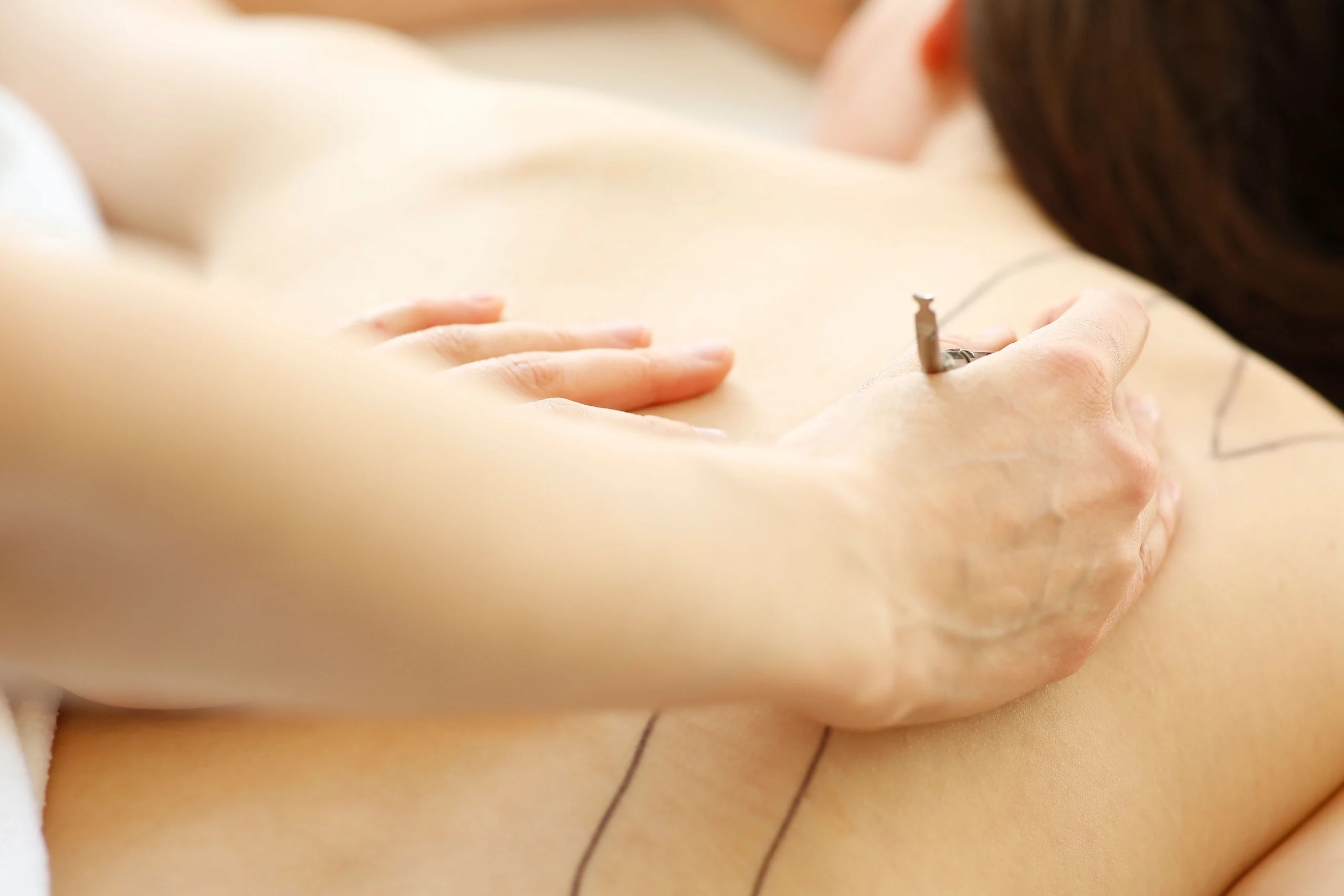 akupunktmassage grevenbroich detail